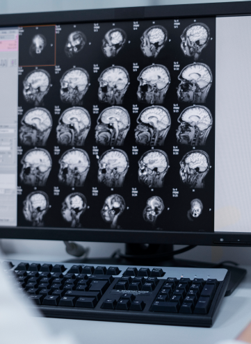 Almacenamiento de Exámenes